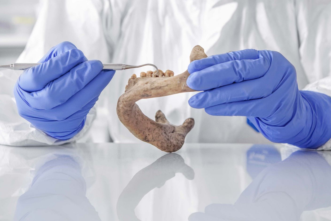 Die Zähne in einem 3000 Jahre alten Unterkiefer versprechen Erfolg. Nirgendwo sonst findet man so viel und so gut erhaltene DNA aus der Frühzeit wie in Zahnstein, weiss Christina Warinner, denn darin sind Nahrungsreste und Bakterien konserviert. Ein 3000 Jahre alter Unterkiefer.