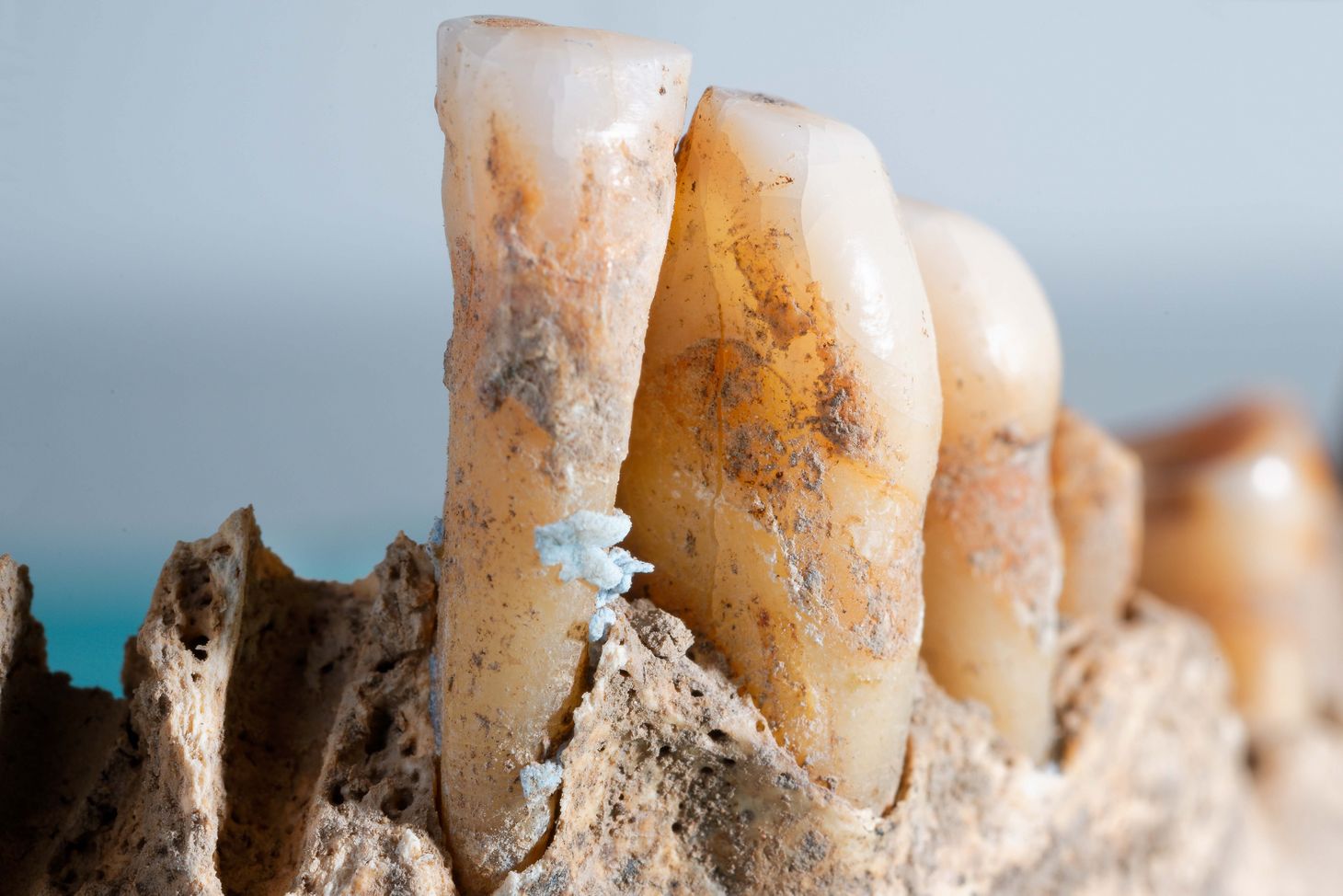 Using ancient DNA for modern cures. Prehistoric dental plaque