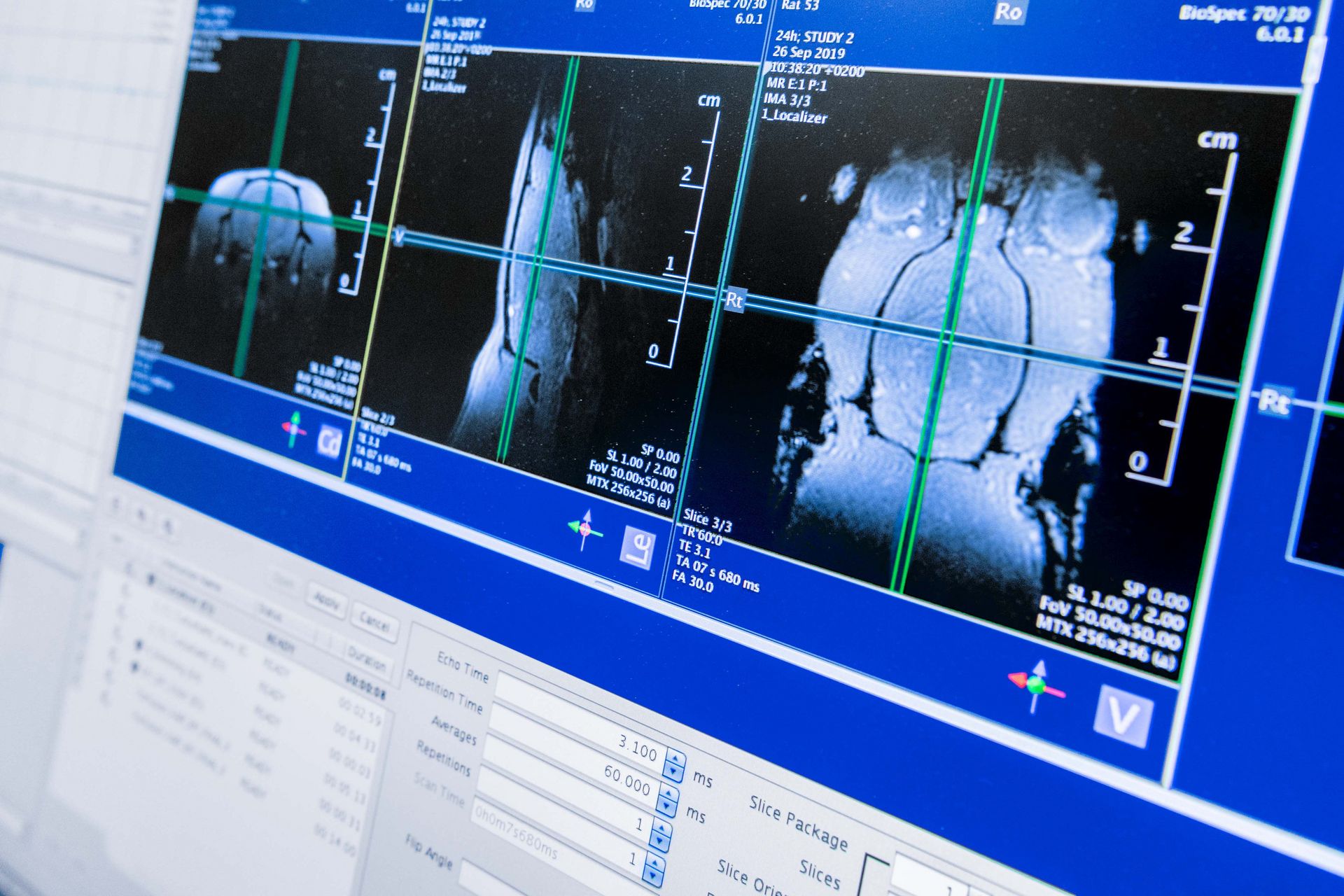 In 2019, a high honour was conferred on the research units for personalised tumour therapies at the Werner Siemens Imaging Center in Tübingen: they became part of Germany’s national Excellence Strategy. Photo of a display.