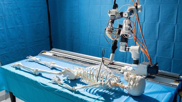 Operation am Oberarmknochen mit Laser und über Roboter gesteuert.