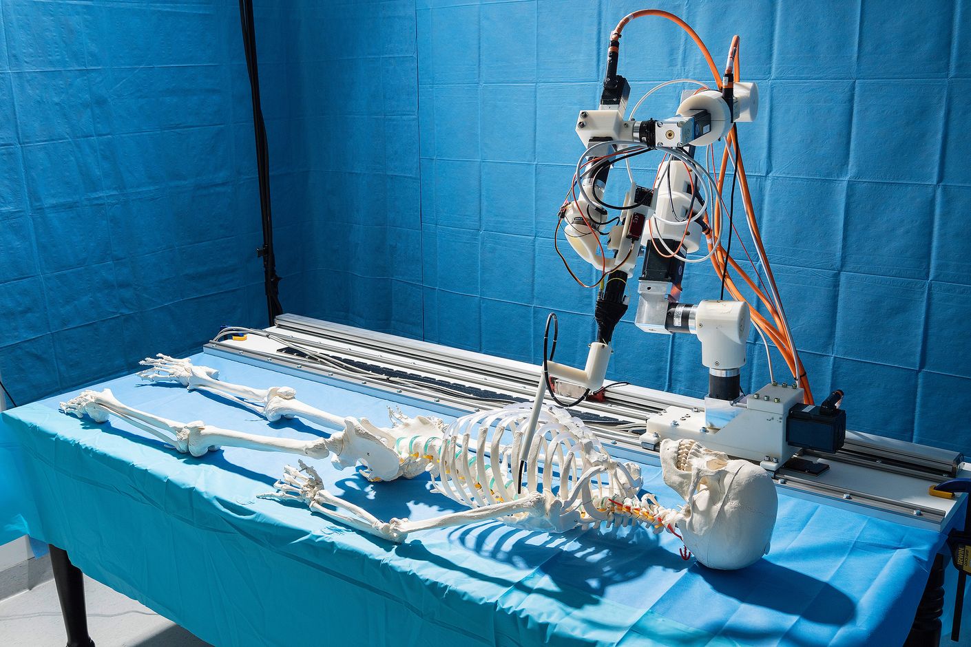 Photo of an operation on a model using robot-guided laser technology