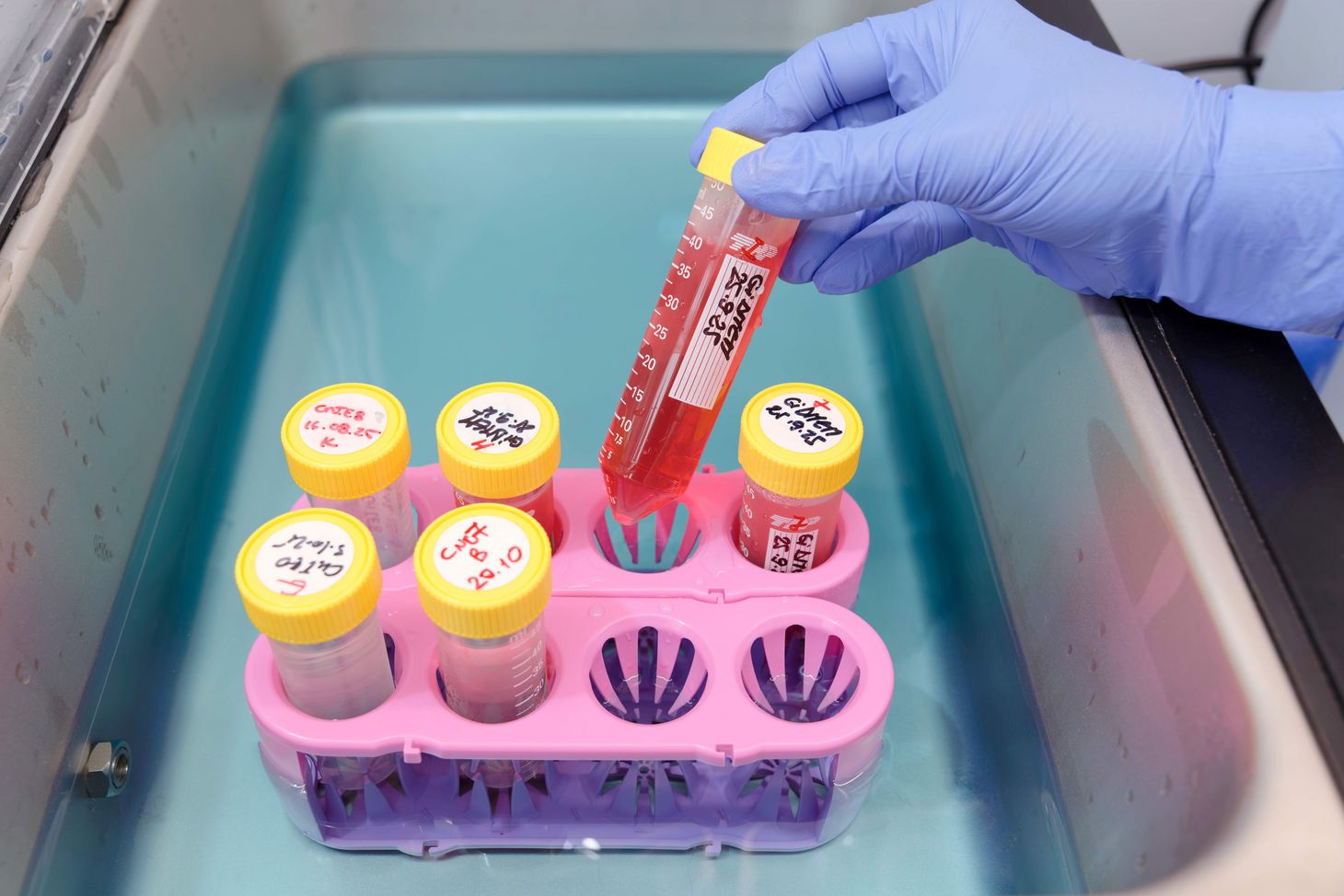 Um die PV-Skin herzustellen, wird eine Hautprobe des Patienten enzymatisch zerlegt und daraus die vier Zelltypen Keratinozyten, Fibroblasten, Melanozyten und Endothelzellen gewonnen und vermehrt.